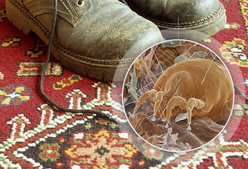 تصویر میکروسکوپی مایت‌های گردوغبار موجود در فرش